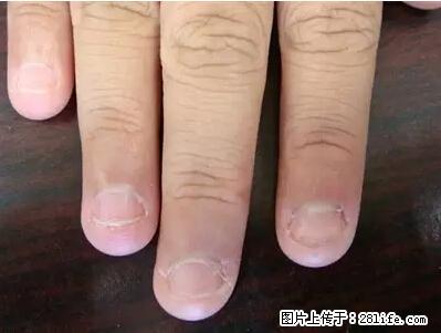 剪指甲、挖耳屎，这些日常小动作竟隐藏大危害！ - 甘孜生活资讯 - 甘孜28生活网 ganzi.28life.net